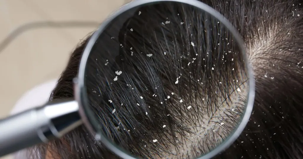 benefits of scalp treatment