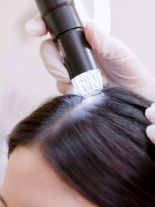 cropped-benefits-of-scalp.jpg