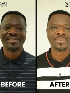cropped-RICHARD-BEFORE-AFTER-IMG.webp