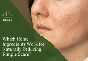 how to remove pimple scars naturally
