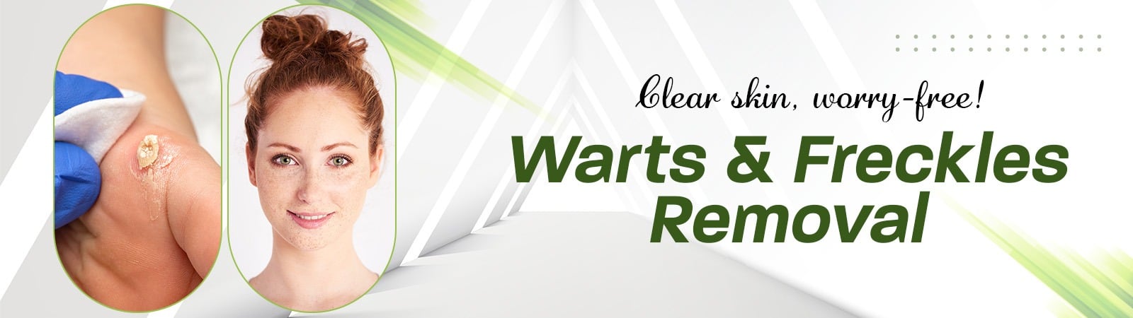 Warts and Freckles Removal