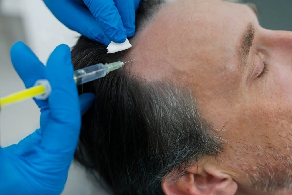Hair regrowth treatment