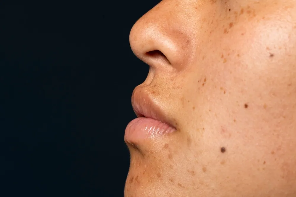 What is Pigmentation