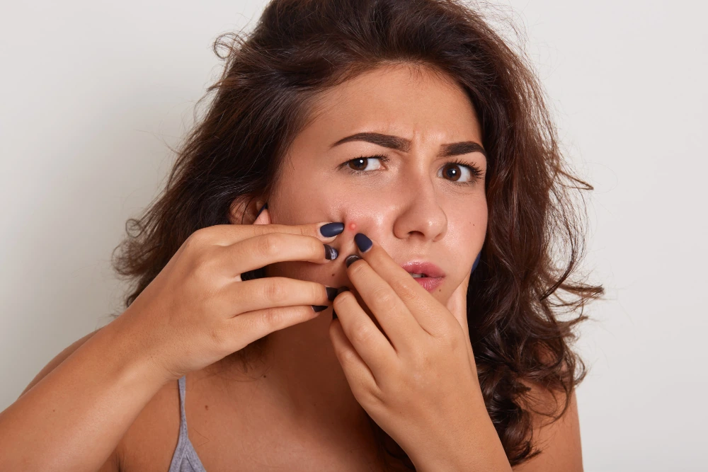 Picking or Popping Pimples