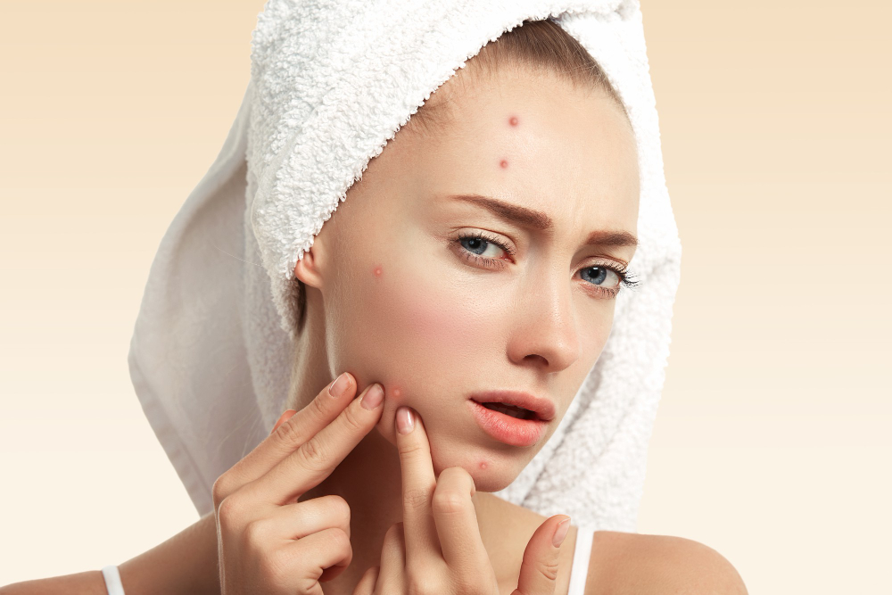 Removes Blackheads and Whiteheads