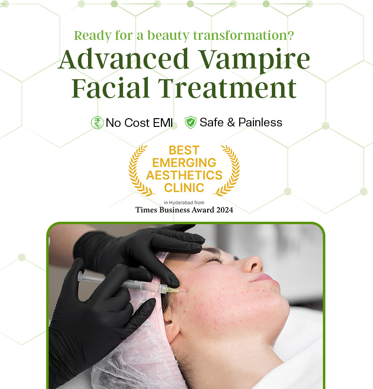 Vampire Facial Treatment