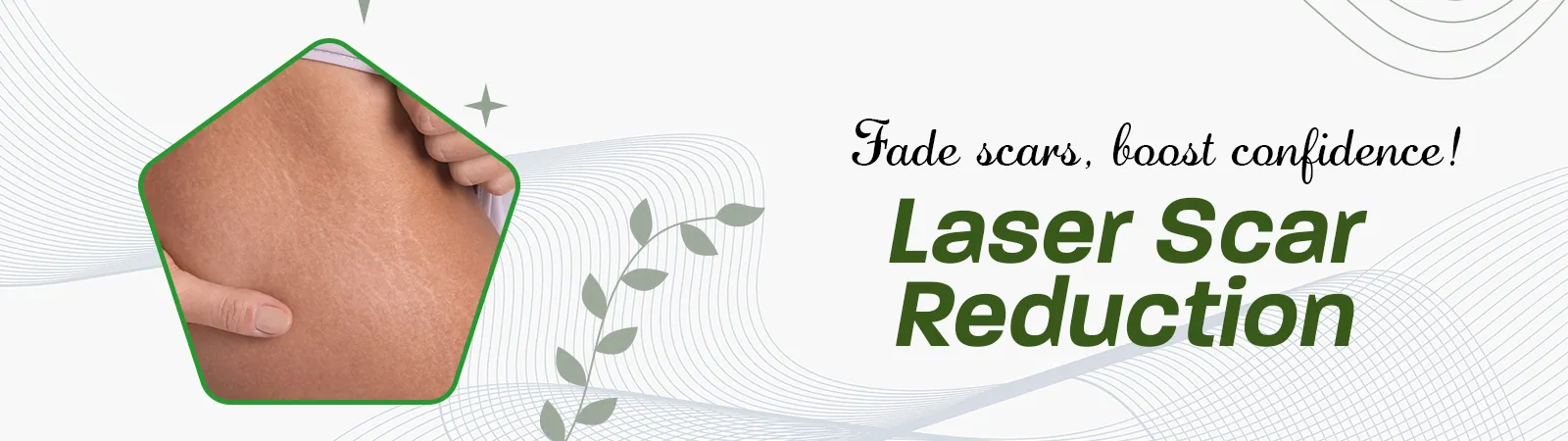 Best Laser Scar Removal Treatment in Hyderabad