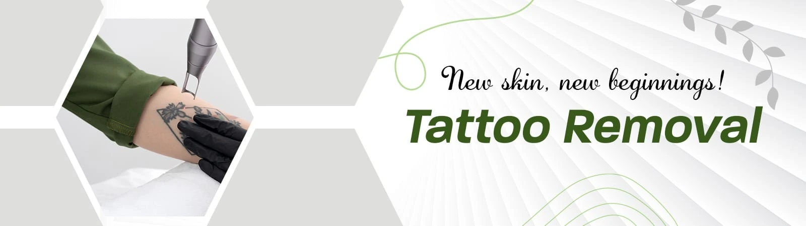Best Laser Tattoo Removal in Hyderabad
