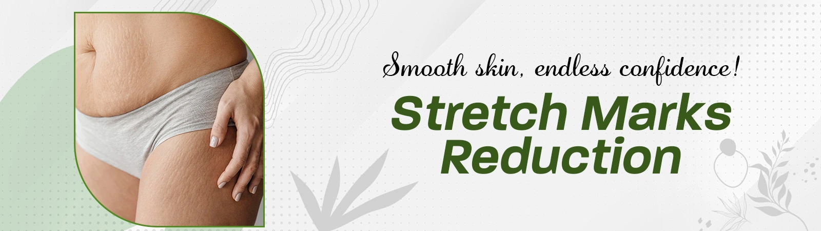 Best stretch marks removal treatment in hyderabad
