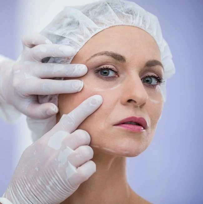 Derma Fillers