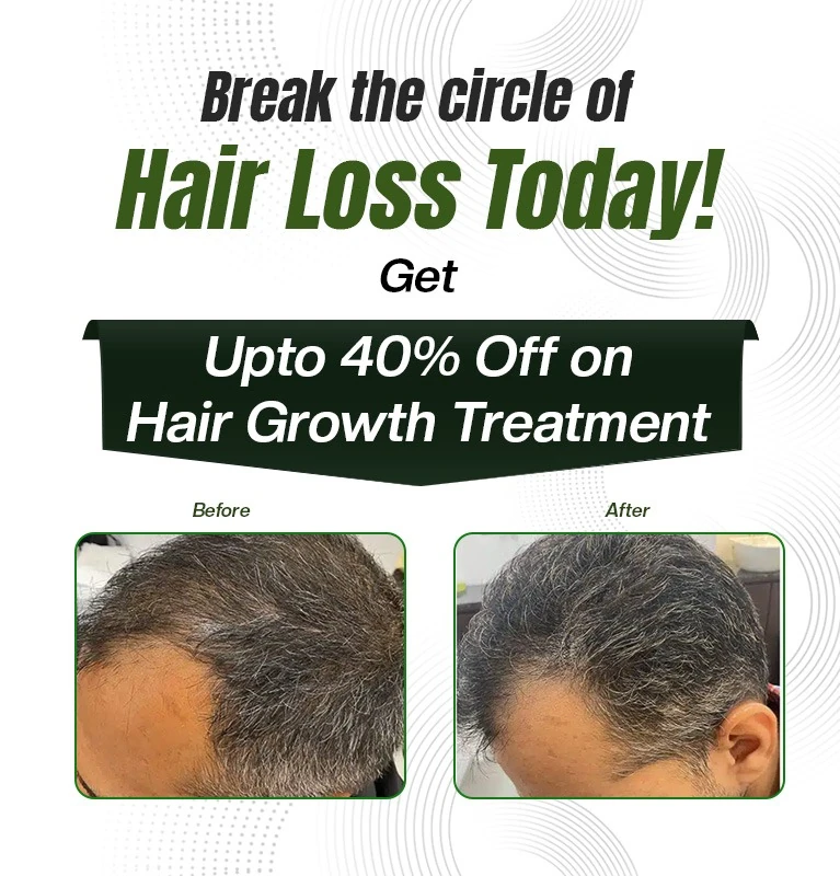 Hair Regrowth 40% off mobile
