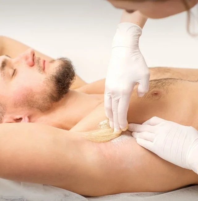 Hyperhidrosis (Excessive Sweating) Treatment