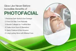 Photofacial Benefits