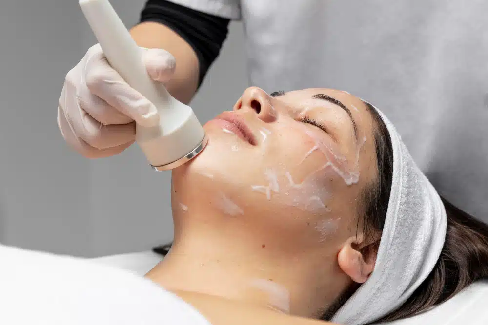 Top 10 Photofacial Benefits