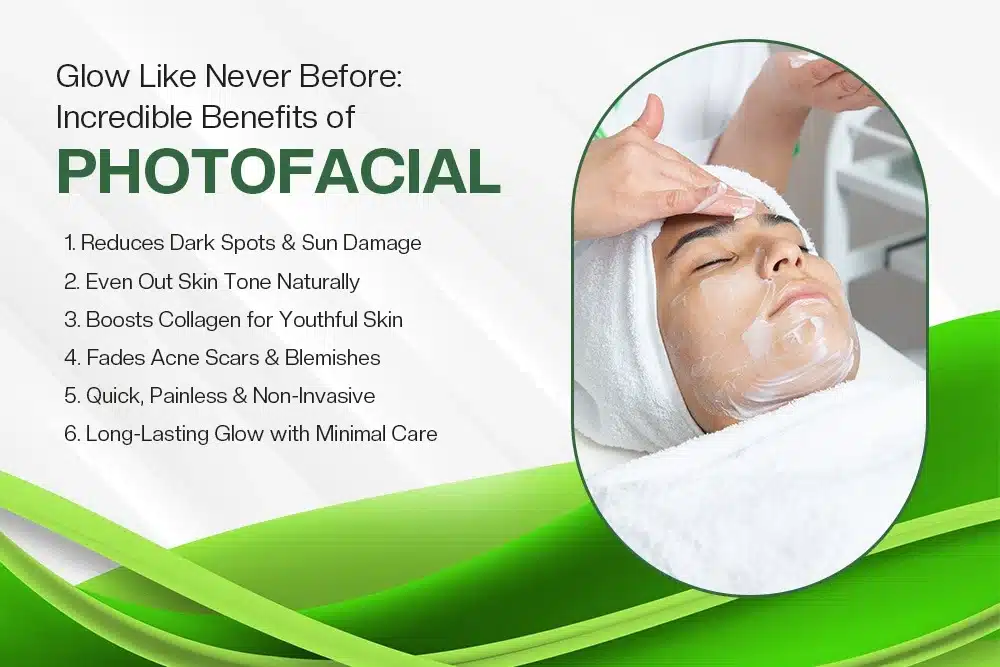 Photofacial Benefits