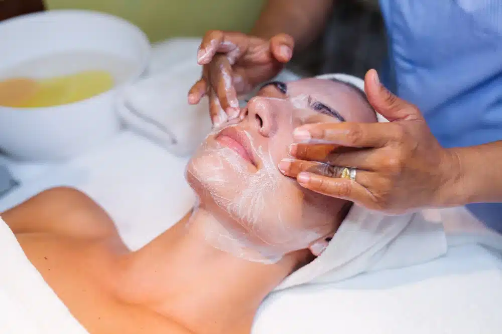 Vampire Facial Procedure