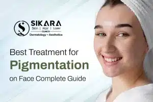 Best Treatment for Pigmentation on Face