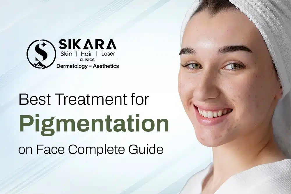 Best Treatment for Pigmentation on Face