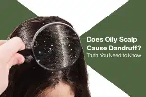 Does Oily Scalp Cause Dandruff