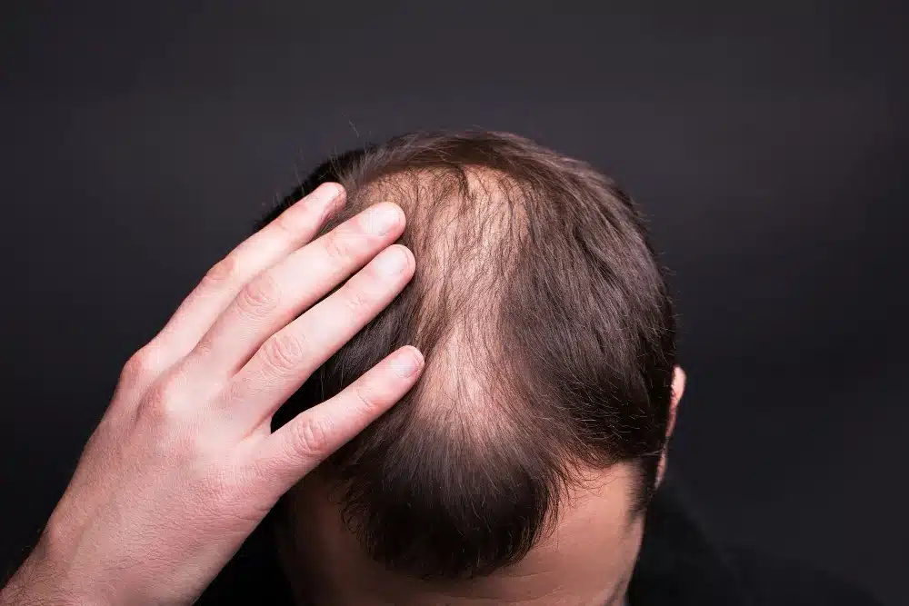GFC Hair Treatment Cost in India