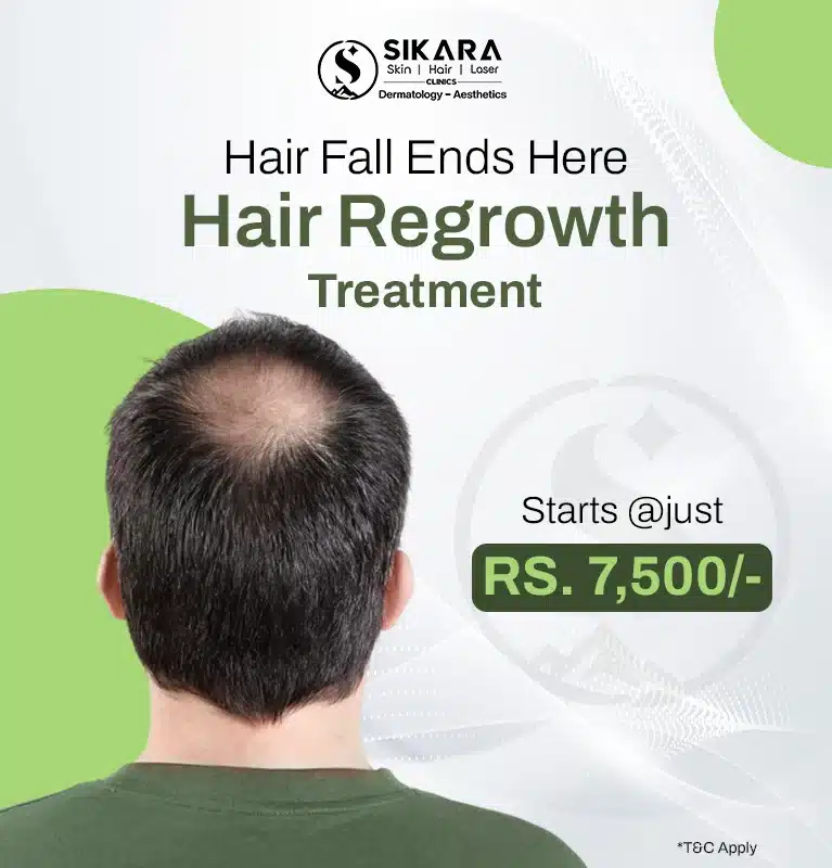 Hair Regrowth Treatment - Sikara Clinics - Mobile