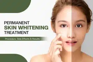 Permanent Skin Whitening Treatment