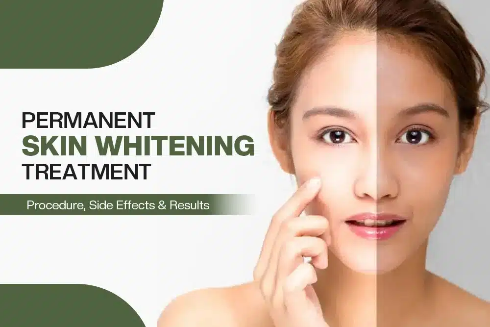 Permanent Skin Whitening Treatment