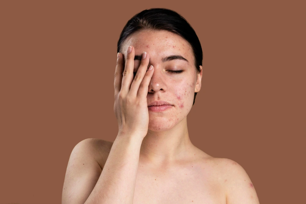 skincare mistakes to avoid