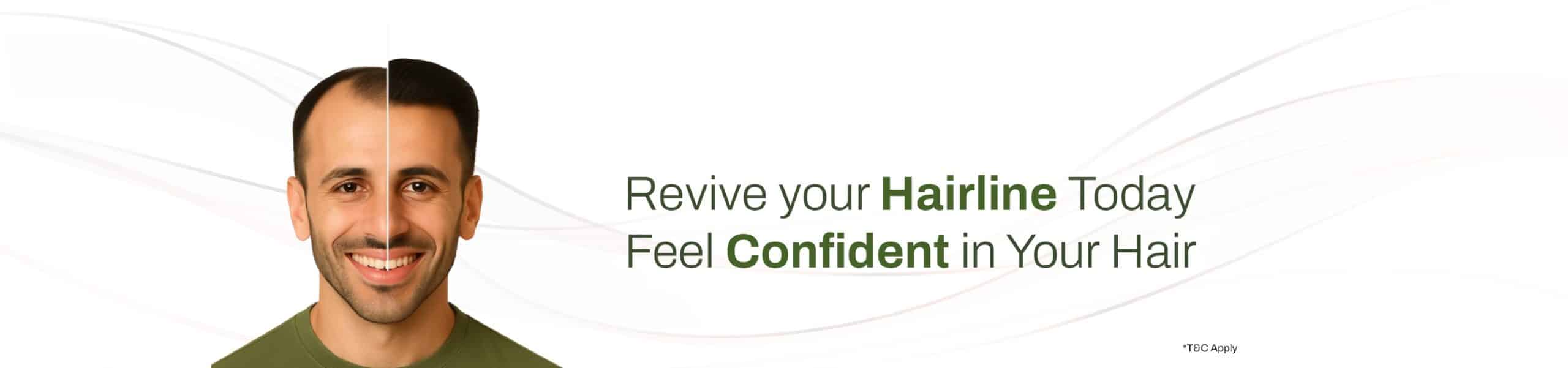 Advaned hair Regrowth Treatment