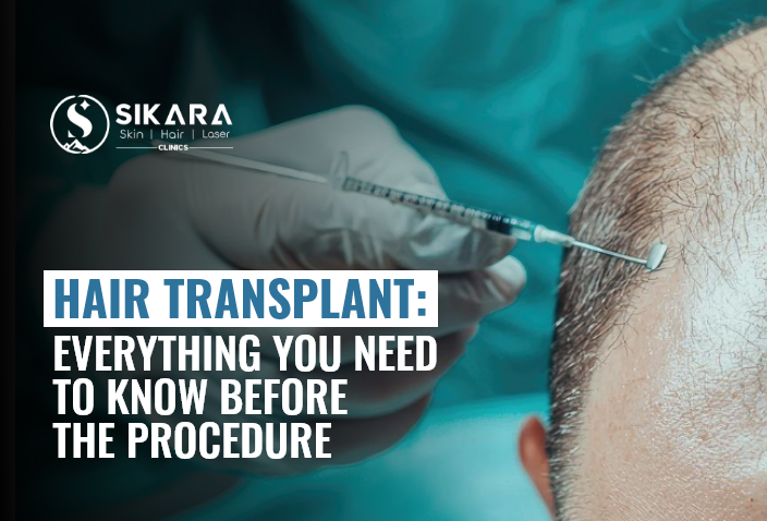 Hair Transplant: Everything You Need to Know Before the Procedure