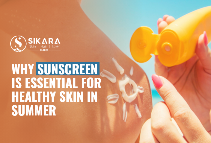 Why Sunscreen is Essential for Healthy Skin in Summer
