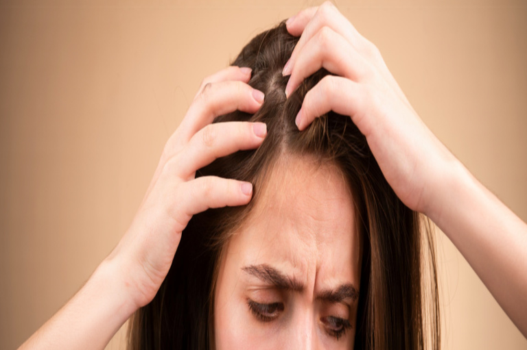 5 Effective Treatments for Hair Thinning in Men and Women