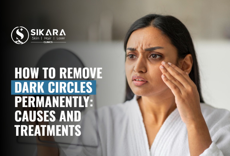 How to Remove Dark Circles Permanently: Causes and Treatments