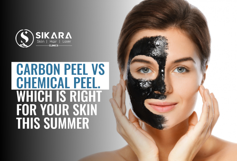 Carbon Peel vs Chemical Peel: What Suits Your Skin This Summer?