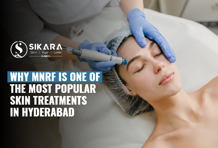 Why MNRF Is One of the Most Popular Skin Treatments in Hyderabad
